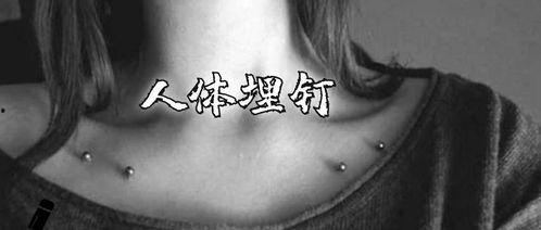 年下锁骨钉,创新医疗技术，重塑骨骼健康新篇章